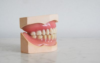 Permanent Dentures Rochester NY: What You Need to Know
