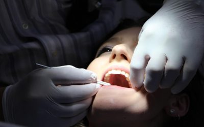Dental Implant Repair in Rochester NY