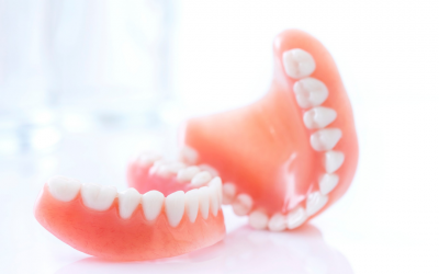Can I Change From Dentures To Dental Implants? 