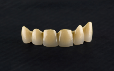 Am I A Candidate For Crown Lengthening?