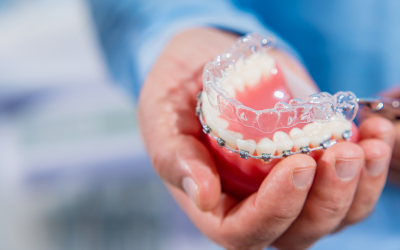 Reasons You Might Need Periodontal Dentistry in Rochester