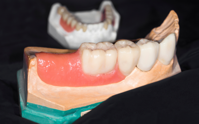Is Gum Disease Genetic? Learn the Answer and Find Treatment