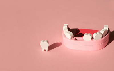 Do Missing Teeth Cause Health Problems? Ask Your Rochester Periodontist