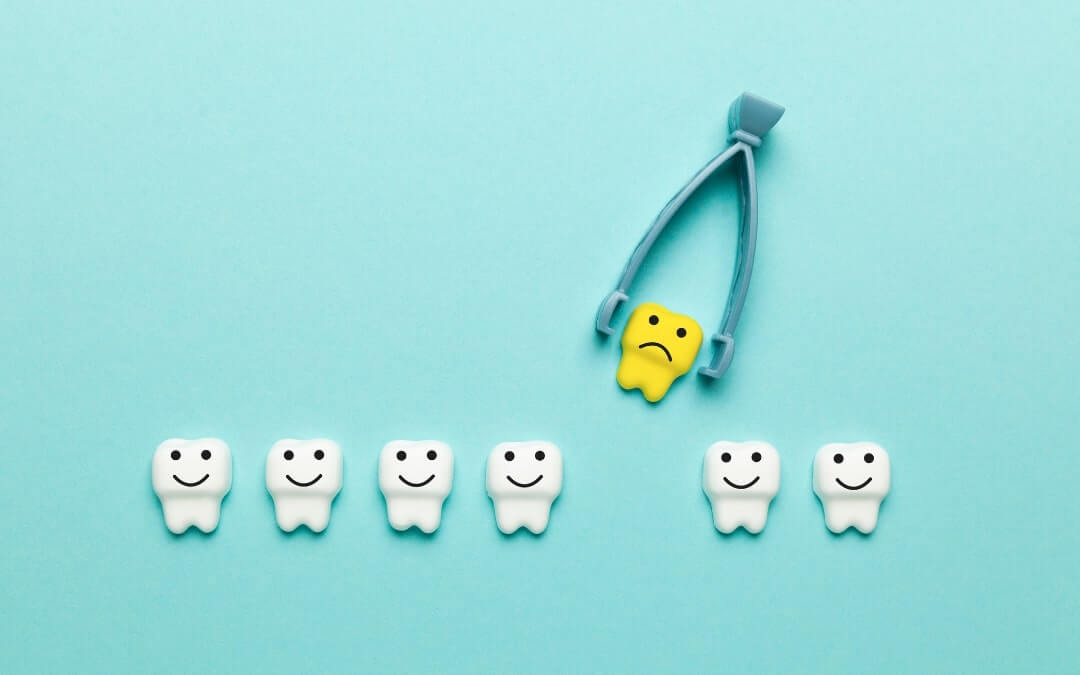 Does Tooth Surgery Hurt As Much As People Say?
