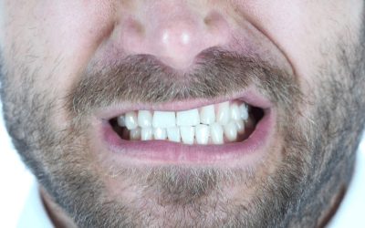 Bruxism and Periodontal Disease: How They’re Related and Recommended Treatments