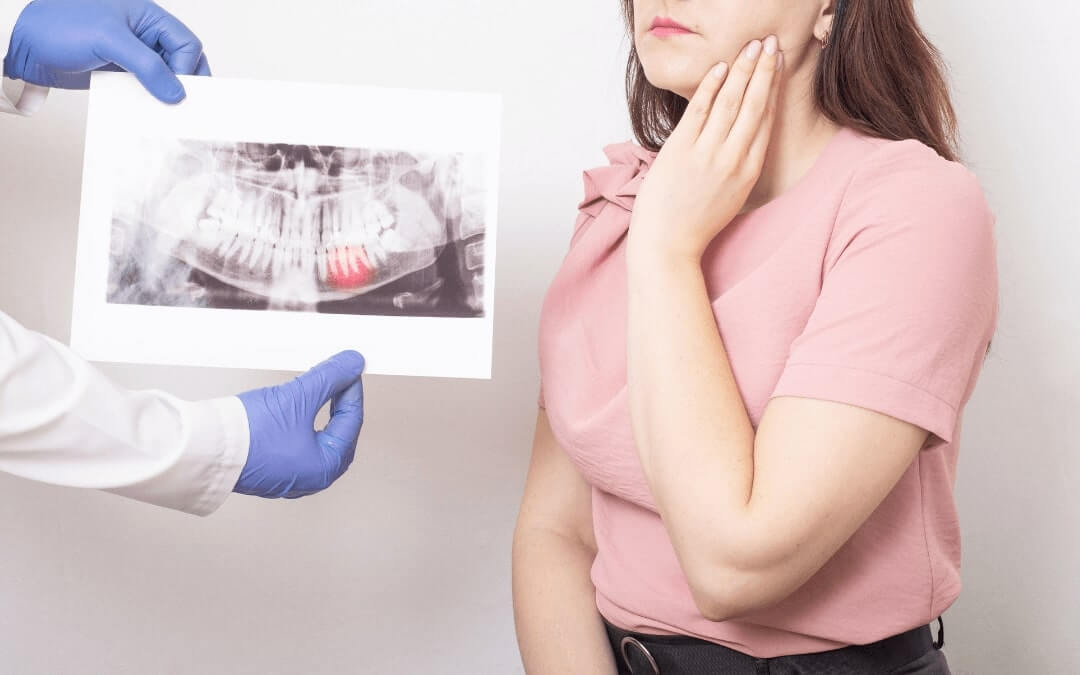 Where To Go For Wisdom Tooth Extraction in Rochester
