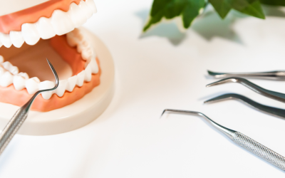 Looking For Periodontal Disease Treatment in Rochester? Start Here!