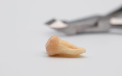 What Causes Tooth and Bone Loss?