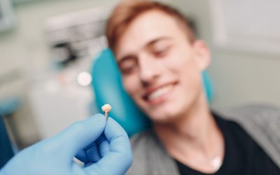 Tips for Dental Implant Recovery