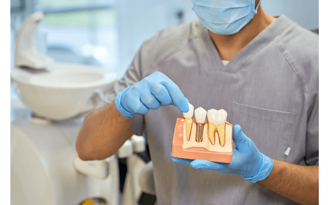 Essential Tips for a Successful Dental Implant Surgery Healing Process