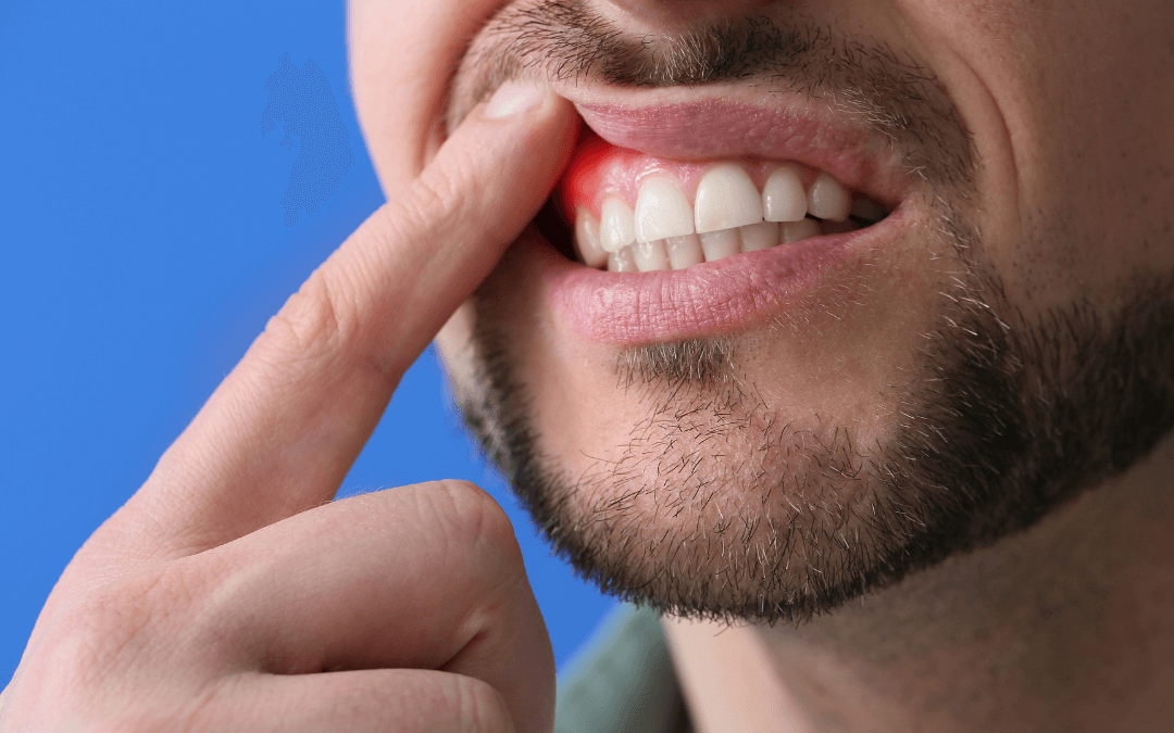 What's the Connection Between Dental Implants and Gum Care?