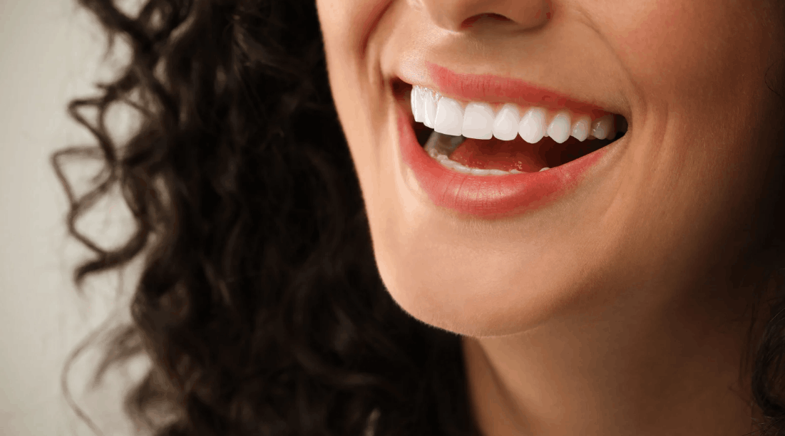 Cosmetic Dentistry in Rochester