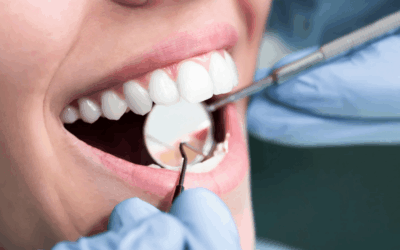 Gum Surgery in Rochester: Procedures, Recovery, and What to Expect