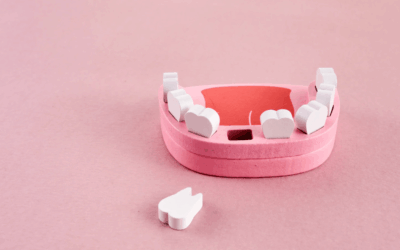 Can Missing Teeth Affect My Face Shape? The Importance of Tooth Replacement