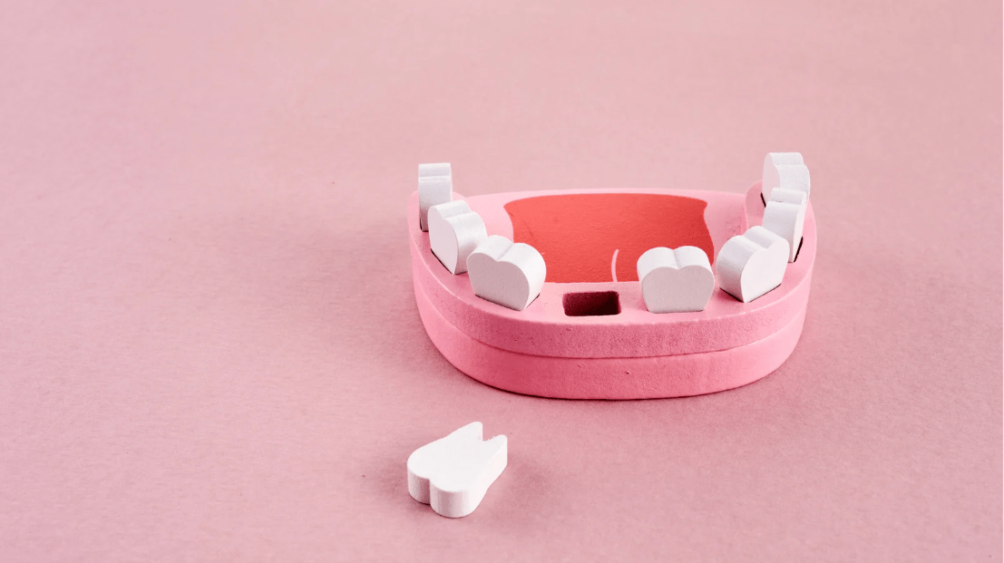 Importance of Tooth Replacement