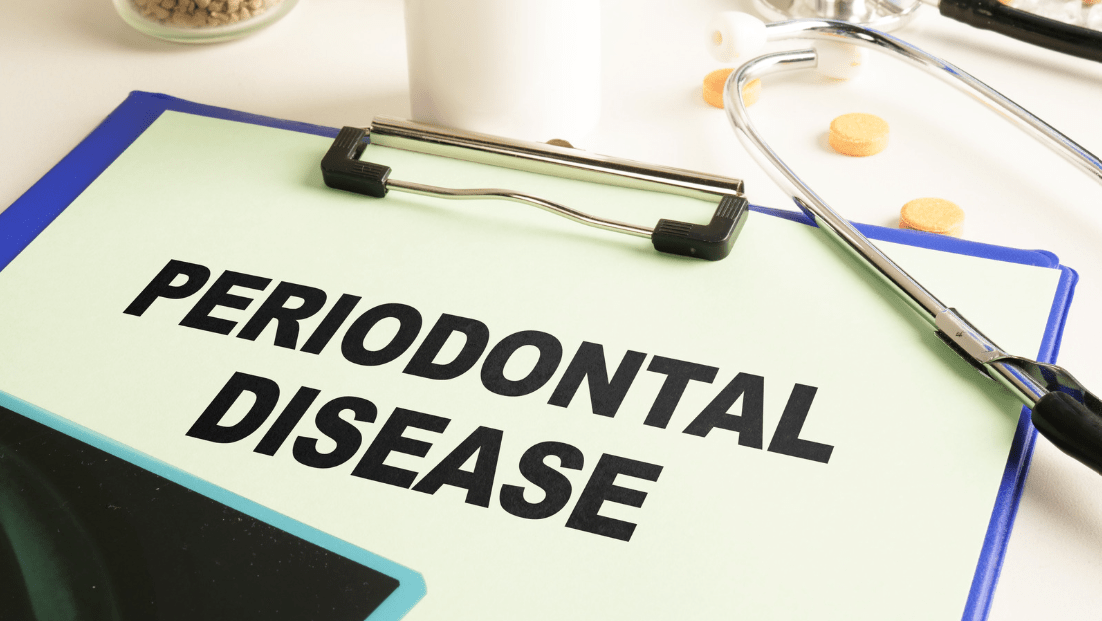 Modern Periodontics in Rochester