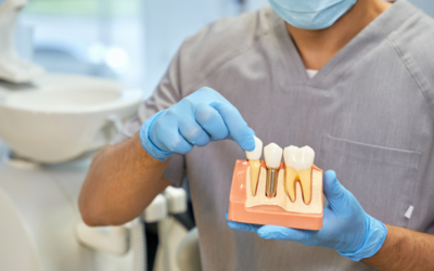 How Painful Are Dental Implants? What Rochester Patients Can Expect