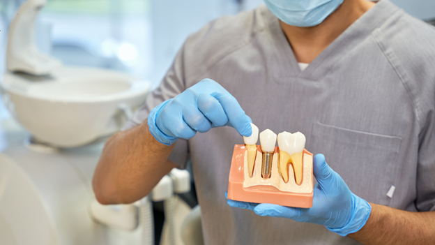 How Painful Are Dental Implants-What Rochester Patients Can Expect How Painful Are Dental Implants? What Rochester Patients Can Expect
