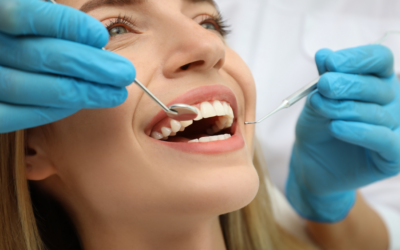 What Is Gum Grafting? How Periodontists Treat Receding Gums
