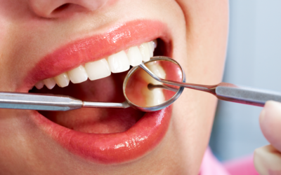 How Scaling and Root Planing Help Treat Early Gum Disease