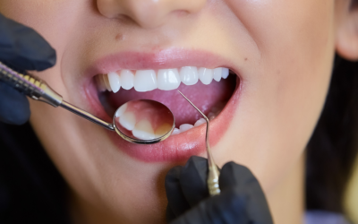 What Are the Signs of Dental Implant Failure?