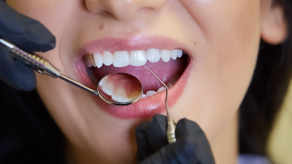 What Are the Signs of Dental Implant Failure What Are the Signs of Dental Implant Failure