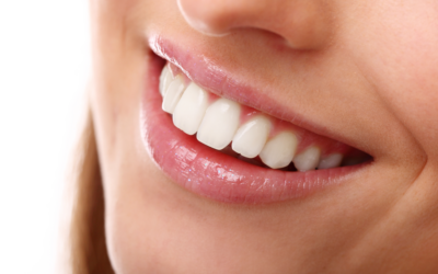Why Healthy Gums Matter Before Cosmetic Dental Treatment
