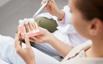 Bone Grafting Before Dental Implants: When Is It Needed?