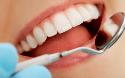 What Are Your Options If You’re Missing Multiple Teeth?