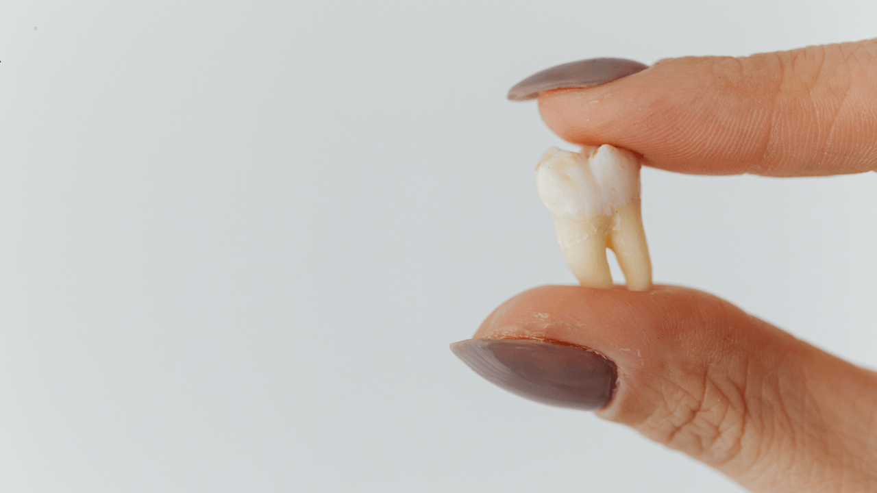 How Gum Disease Can Lead to Tooth Loss